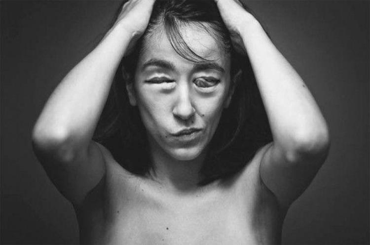 超重口味摄影集肢体重组宛如寄生兽